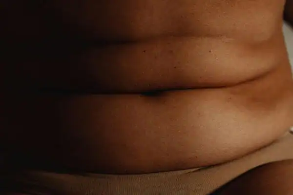 The Hidden Connection: How Stress Shapes Your Fitness and Body Composition 3 image of what stress can do on the stomach area and how Lipo 360 Bury St Edmunds can help to change your body shape.
