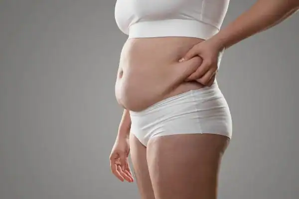 Image of stress belly Bury St Edmunds How Lipo 360 can help manage your symptoms